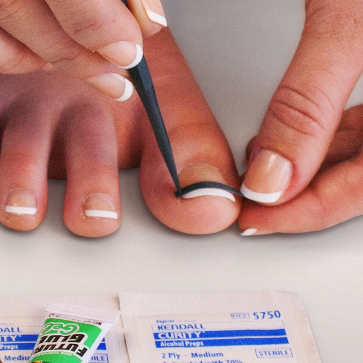 NailEase ingrown nail treatment